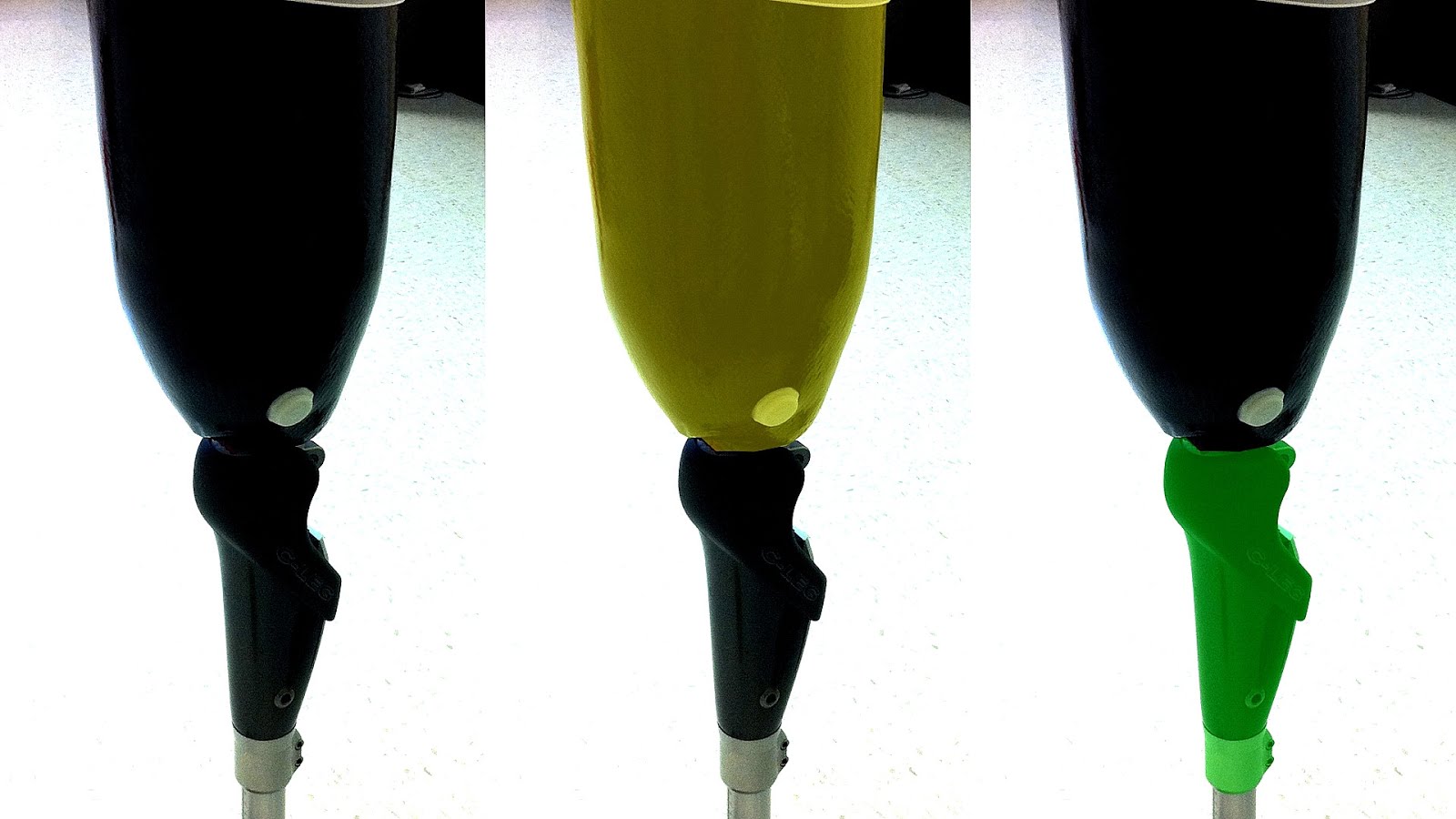 Prosthesis medical definition picture