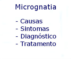 Micrognatia causas sintomas diagnóstico tratamento prevenção riscos complicações