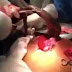 Homem introduz enguia dentro do ânus e médicos descobrem que o peixe estava vivendo dentro do seu intestino
