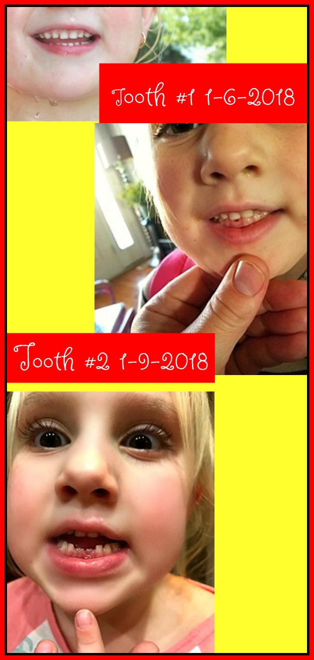 Preslie looses 1st and 2nd Tooth