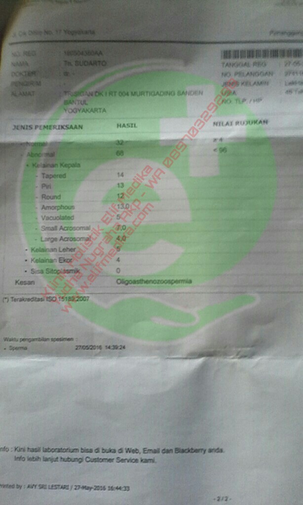 Setelah 1 bulan pengobatan jumlah sperma total naik menjadi 15,6 juta/ejakulasi. Setelah 1 bulan pengobatan jumlah sperma total naik menjadi 15,6 juta/ejakulasi.
