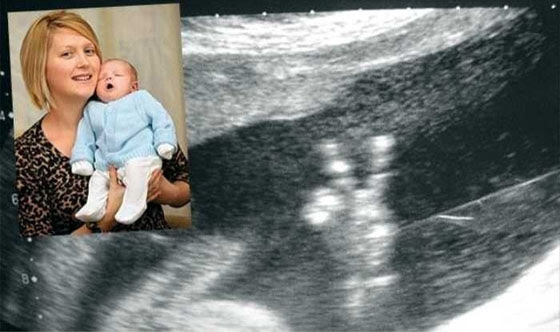 Photo : 産まれる前から、カメラに向かって、ピースサインする、ノリのいい赤ちゃん ! !