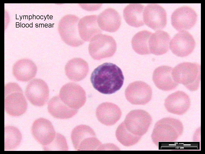 Пролимфоциты фото. Leucocytus это. Lymphocytus значение ТЭ. Leucocytus PNG. Lymphocytus