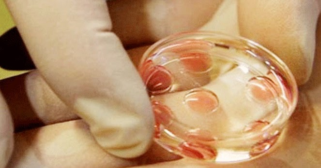 Hukum Pencangkokan Sperma (Bayi Tabung) dalam Islam ...