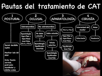 Que provoca el dolor en la espalda