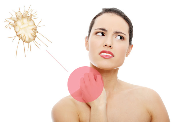 Natural Home Remedy For Scabies Natural Home Remedy For Scabies