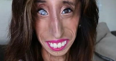 The World's Ugliest Woman" Lizzie Velasquez is fighting back...in...