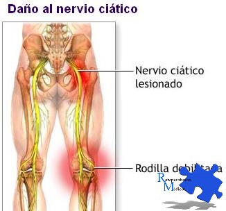 debilidad en la pantorrilla dolor en la rodilla