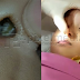 (Video) Tak Sangka Anak Masukkan 'Benda' Dalam Hidung