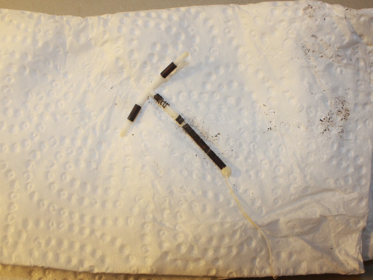 Paragard IUD. The Ugly Rusty Fishy Truth Regarding My Experience