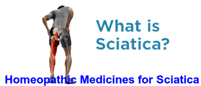 HOMOEOPATHIC REMEDIES FOR SCIATICA