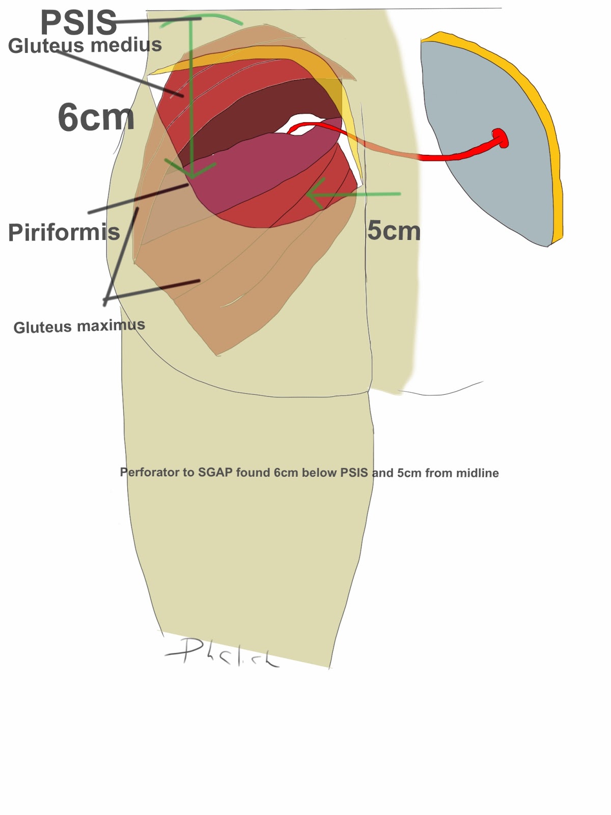 MI4 (Microsurgery Institute 4): Breast