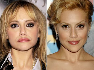 Brittany Murphy Plastic Surgery Before and After Photos