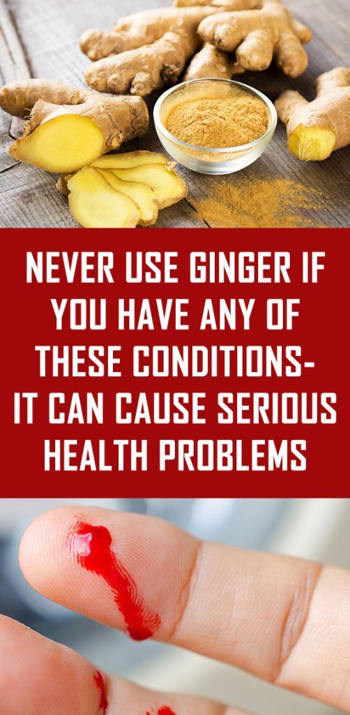 Don’t Use Ginger If You Have Any Of These Conditions, It Can Cause
