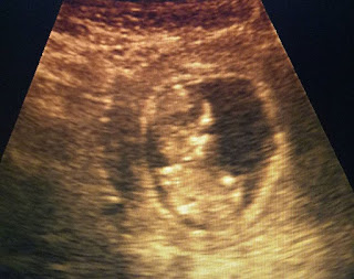 12 haftalık gebelik görüntüleri