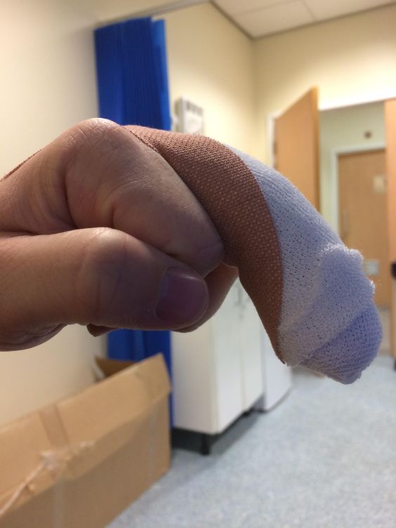 wounded finger. Dirty Mind Pictures