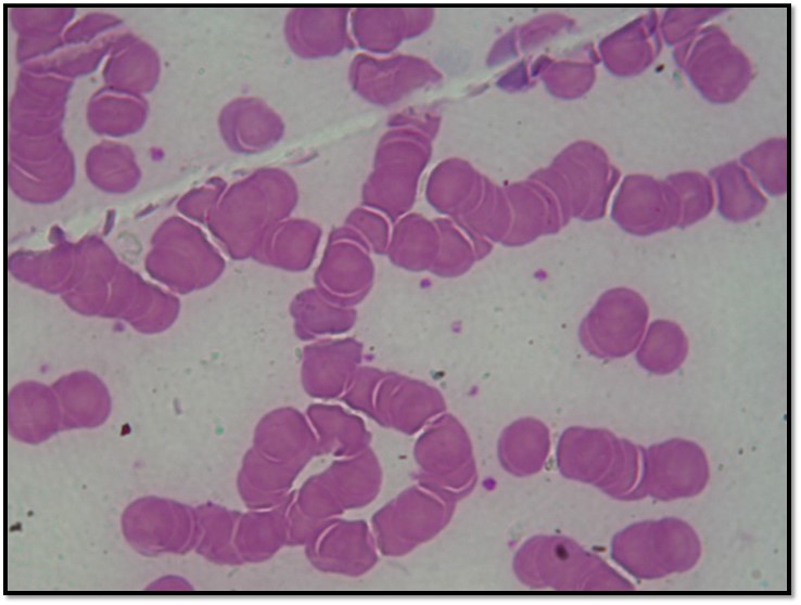 Atlas de Hematologia