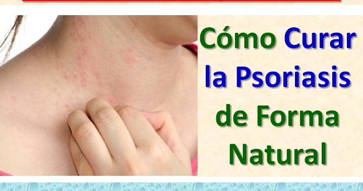 Los balnearios rusos para el tratamiento de la psoriasis