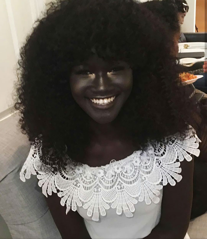 “One of my goals is to make all my dark-skinned sisters out there laugh at those with their “beauty standards””” - Teen Bullied For Her Incredibly Dark Skin Color Becomes A Model, Takes The Internet By Storm “One of my goals is to make all my dark-skinned sisters out there laugh at those with their “beauty standards””” - Teen Bullied For Her Incredibly Dark Skin Color Becomes A Model, Takes The Internet By Storm