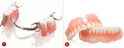 Trồng răng giả có thật sự tốt?
