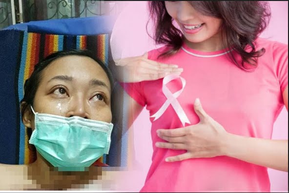 Bisa Jadi Alternatif Penderita Kanker Payudara Selain Kemoterapi Ternyata Metode Ini Dibilang Paling Ampuh Bisa Jadi Alternatif Penderita Kanker Payudara Selain Kemoterapi Ternyata Metode Ini Dibilang Paling Ampuh