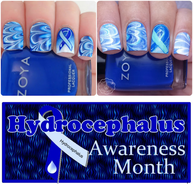 Hydrocephalus Awareness Bestie Nails & Giveaway