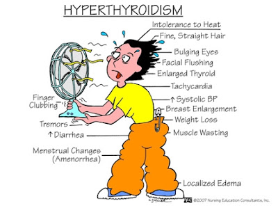 Soalan 32: Rawatan Hyperthyroid