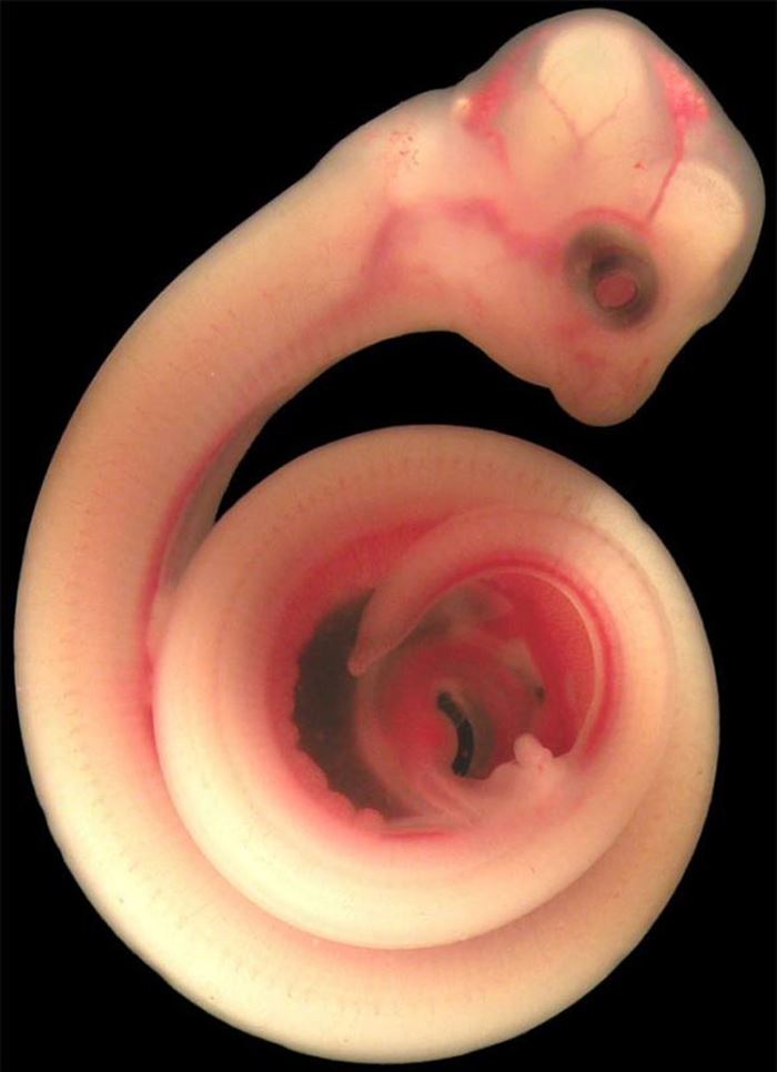 12 Wonderful Pictures of Unborn Animals in the Womb - Snake