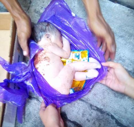 Baby Jade survived after being dumped in garbage can