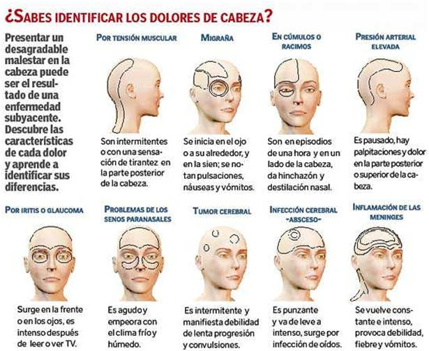 La presión barométrica causa dolor de cabeza