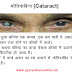Motiyabind Cataract-Eyes Diseases