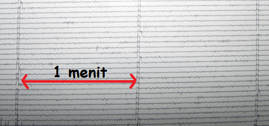 Earthquake Seismograph Analog as Earthquake Instrumentation Earthquake Seismograph Analog as Earthquake Instrumentation