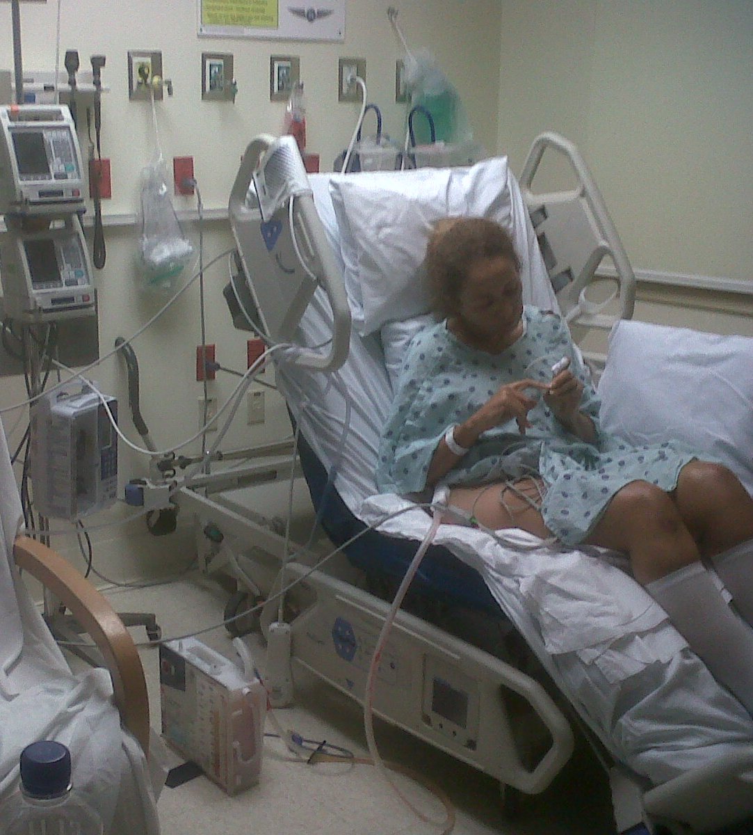 TITANIUM RIB PLATING MEMORIAL REGIONAL HOSPITAL, FLORIDA