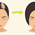 Baking Soda Stops Hair Loss & Promotes Hair Growth In No Time!