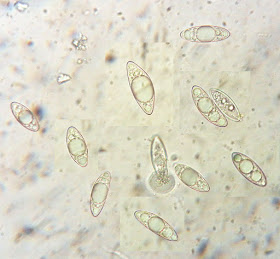 Microstoma protractum spores