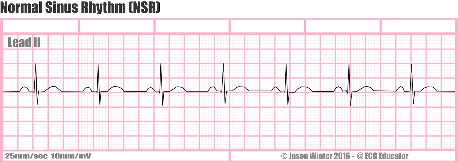 1. EKG Heartbeat Nail Design - wide 9