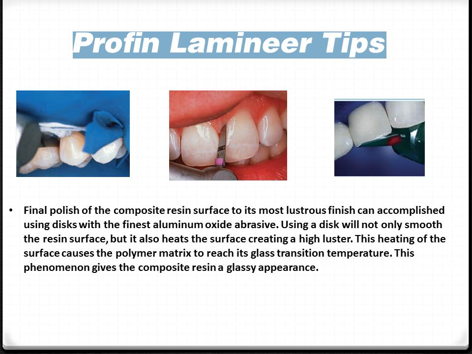 DOs and DONTs in DENTISTRY Polishing Composite Restorations EASY