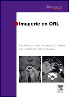 imagerie - Imagerie en ORL - Page 2 41beVtxkCyL._SX351_BO1%252C204%252C203%252C200_