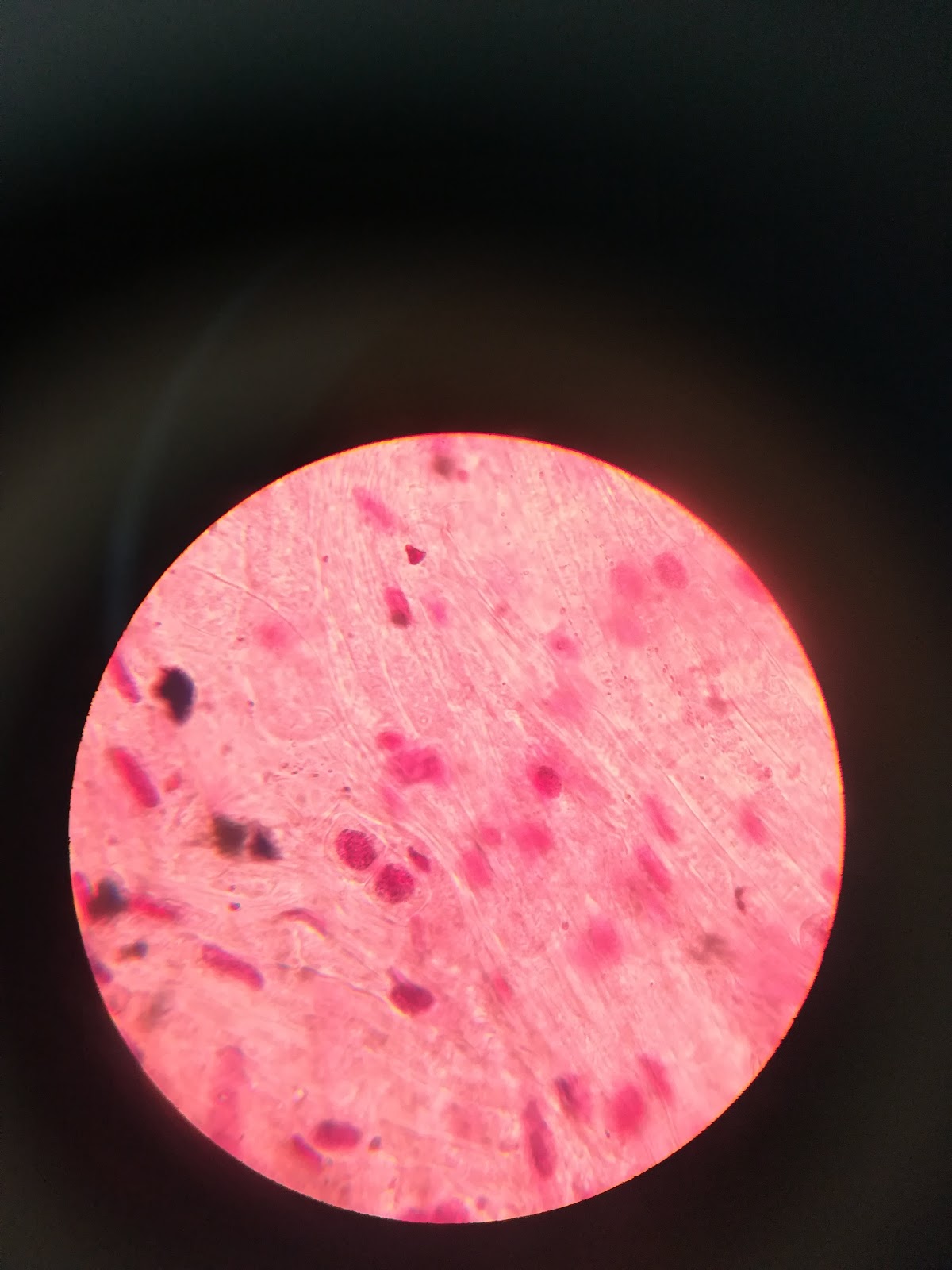 Práctica de la mitosis en el meristemo apical de las células de cebolla