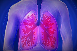 Chronic Bronchitis (COPD) - Causes, Symptoms, and Treatment Chronic Bronchitis (COPD) - Causes, Symptoms, and Treatment