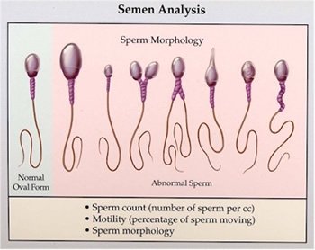 Remarkable, the Male peeing kills sperm Male peeing kills sperm consider, that