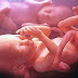Εξωσωματική γονιμοποίηση και πολύδυμες εγκυμοσύνες
