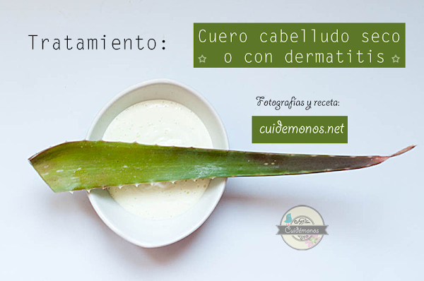 Tratamiento casero para cuero cabelludo seco o con dermatitis