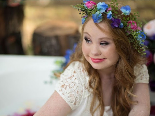 Lenggang Madeline, Model Down Syndrome di Panggung Dunia Lenggang Madeline, Model Down Syndrome di Panggung Dunia