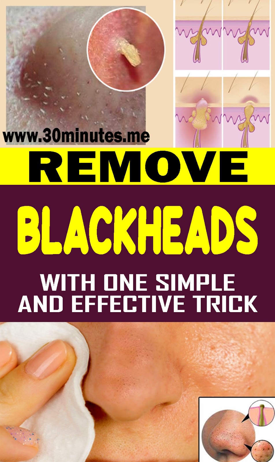 Remove Blackheads With One Simple And Effective Trick HEALTH and WELLNESS