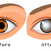 This Common Activity is Now OFFICIALLY Linked to Blindness!