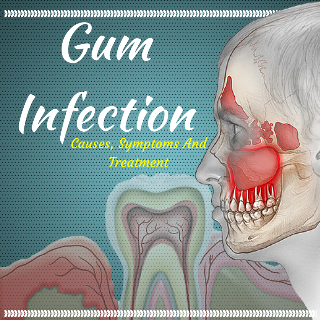 Reviews Lounge What Are The Causes, Symptoms And Treatment For Gum