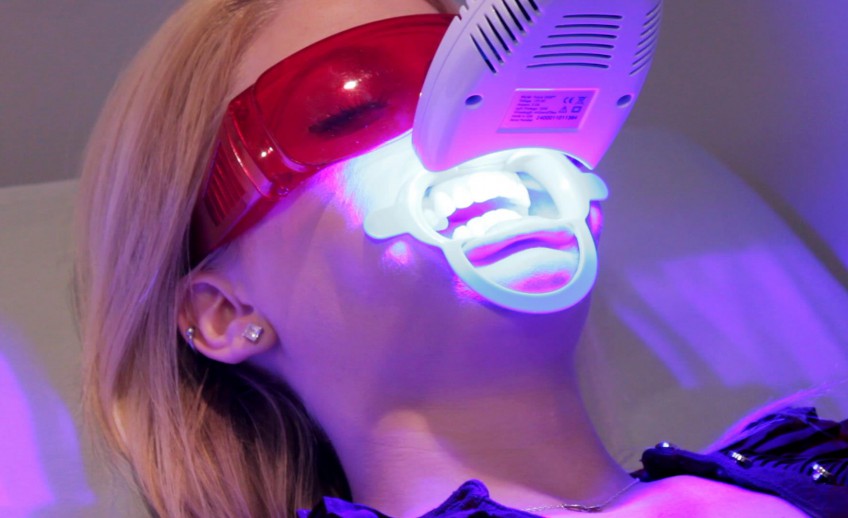Laser Teeth Whitening Dubai
