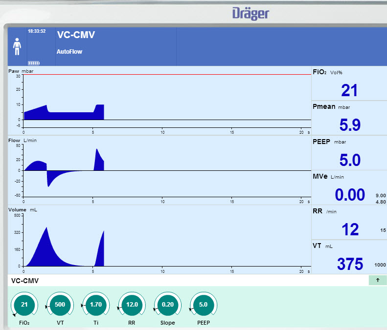 FREMITUS The Volume Control Ventilation Fallacy