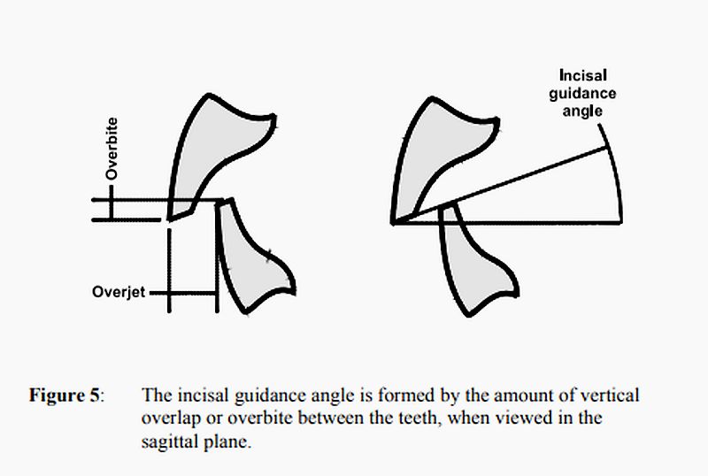 PDF Occlusion in Complete Dentures C P Owen